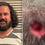 florida-man-bit-chunk-out-of-deputy’s-head-during-assault-at-music-festival:-sheriff’s-office